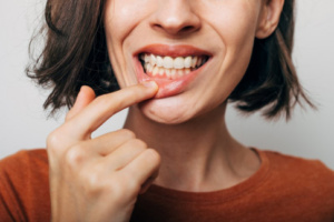 Woman pulling back her lip to show her teeth